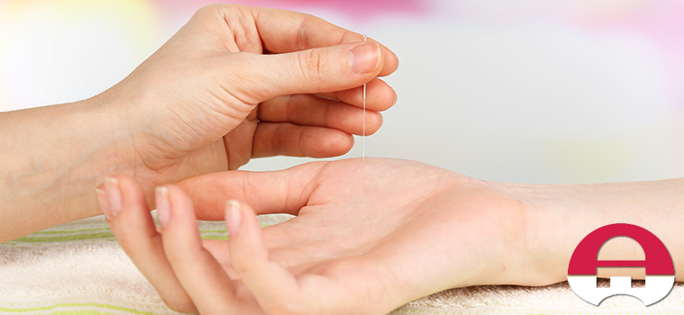 what to expect with acupuncture treatments